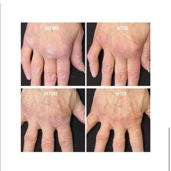 $4 🌙 First Aid Beauty Ultra Repair Cream NEW - Picture 5 of 7